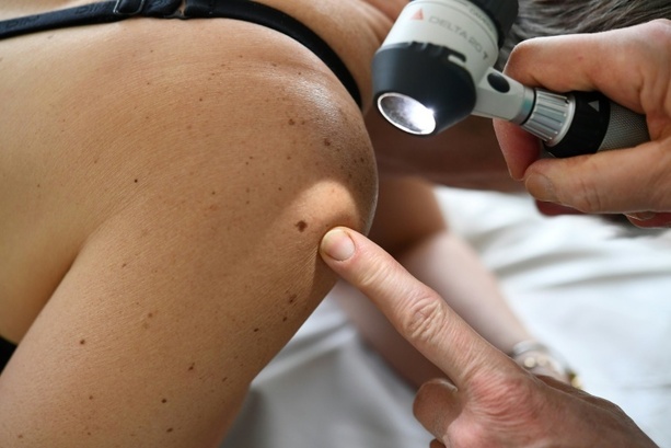 Bild vergr&ouml;&szlig;ern: RKI: Etwa 517.800 Menschen erhielten 2023 Krebsdiagnose - Sterblichkeit rückläufig