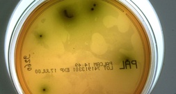 Rückruf von Lebensmitteln: Listerien sind häufigste Ursache