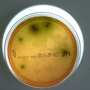 Bild vergr&ouml;&szlig;ern: Rückruf von Lebensmitteln: Listerien sind häufigste Ursache