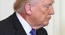 Roter Ausschlag an Trumps Hals sorgt für neue Spekulationen - Arzt nennt 