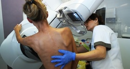 Studie: Früherkennung trägt zu sinkenden Brustkrebssterberaten in Europa bei