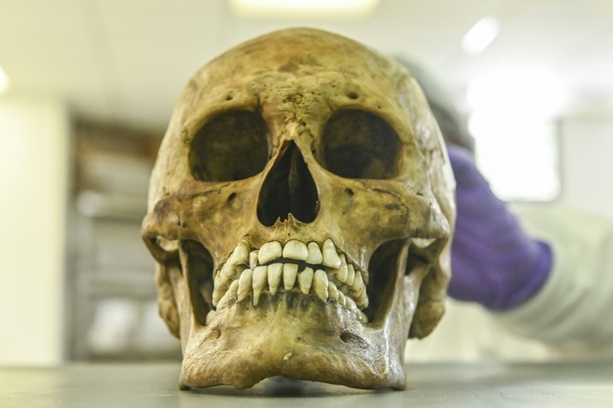 Bild vergr&ouml;&szlig;ern: Identität von in Rheinland-Pfalz gefundenem Schädel aufgeklärt