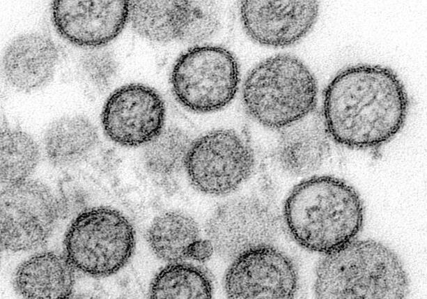 Bild vergr&ouml;&szlig;ern: WHO: Hantavirus auf Schiff wurde von Mensch zu Mensch übertragen
