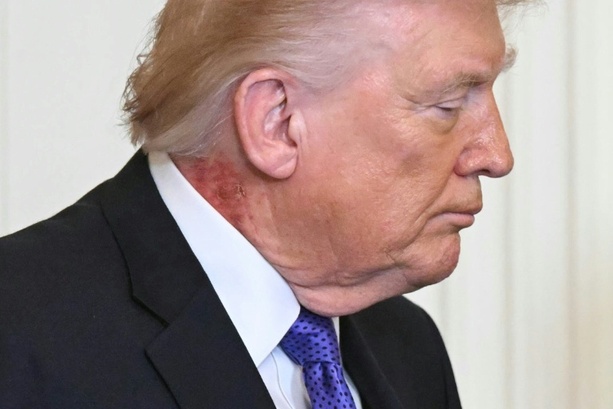 Bild vergr&ouml;&szlig;ern: Trump unterzieht sich jährlichem Gesundheitscheck