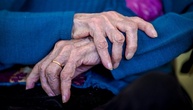 Demenzfälle könnten in Deutschland bis 2060 auf über zwei Millionen steigen