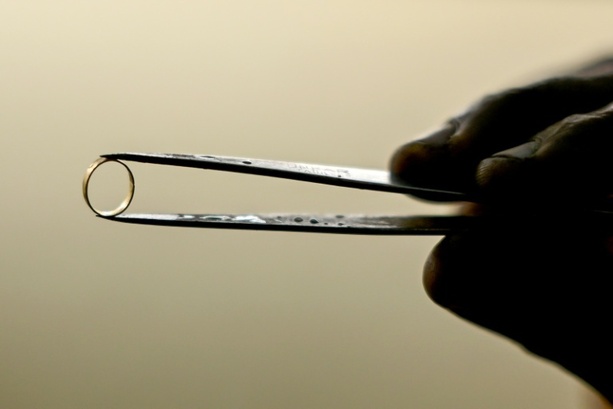 Bild vergr&ouml;&szlig;ern: In Plastiktüte vergraben: Kinder finden 60 goldene Ringe in Waldstück in Bayern