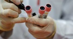 Karlsruhe billigt Blutentnahmeverbot für Heilpraktiker bei bestimmten Eigenbluttherapien