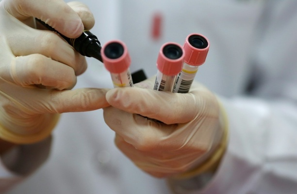 Bild vergr&ouml;&szlig;ern: Karlsruhe billigt Blutentnahmeverbot für Heilpraktiker bei bestimmten Eigenbluttherapien
