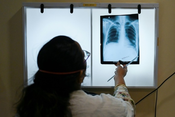 Bild vergr&ouml;&szlig;ern: Impfallianz: Neue Tuberkulose-Impfstoffe könnten Millionen Leben retten
