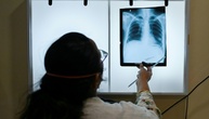 Impfallianz: Neue Tuberkulose-Impfstoffe könnten Millionen Leben retten