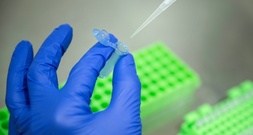 Genschere Crispr: Erste reguläre Behandlung von Patient in Deutschland