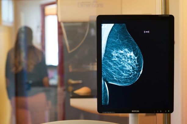 Bild vergr&ouml;&szlig;ern: Mammografie: Altersgrenze für Brustkrebs-Früherkennung wird herabgesetzt